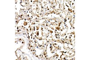 Immunohistochemistry of paraffin-embedded human lung using BHLHE40 Rabbit pAb (ABIN6129354, ABIN6137550, ABIN6137551 and ABIN6222195) at dilution of 1:150 (40x lens). (BHLHE40 抗体  (AA 173-412))
