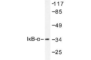 Image no. 1 for anti-Nuclear Factor of kappa Light Polypeptide Gene Enhancer in B-Cells Inhibitor, alpha (NFKBIA) antibody (ABIN265483) (NFKBIA 抗体)