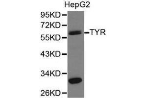 Western Blotting (WB) image for anti-Tyrosinase (TYR) antibody (ABIN1875241)