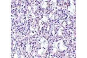 Immunohistochemistry of Carabin in human spleen tissue with Carabin antibody at 2. (Carabin 抗体  (N-Term))