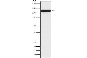 Western blot analysis of BubR1 expression in HepG2 cell lysate.