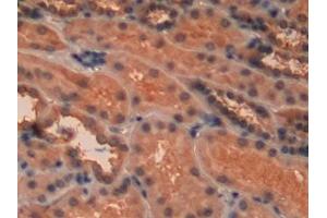 Detection of PKCe in Human Kidney Tissue using Polyclonal Antibody to Protein Kinase C Epsilon (PKCe) (PKC epsilon 抗体  (AA 403-672))