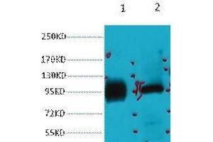 Western Blot (WB) analysis of 1) HeLa, 2) 293T, diluted at 1:2000. (ABCB5 抗体)