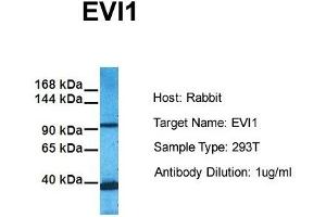 Host: Rabbit Target Name: EVI1 Sample Tissue: Human 293T Antibody Dilution: 1. (MECOM 抗体  (C-Term))