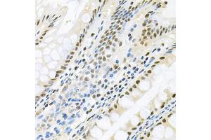 Immunohistochemistry of paraffin-embedded human colon using MAPK8 antibody. (JNK 抗体)