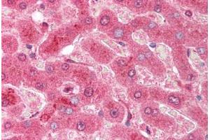 Human Liver (formalin-fixed, paraffin-embedded) stained with CASP3 antibody ABIN214076 at 10 ug/ml followed by biotinylated goat anti-rabbit IgG secondary antibody ABIN481713, alkaline phosphatase-streptavidin and chromogen. (Caspase 3 抗体  (AA 166-183))