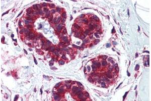 Human Breast: Formalin-Fixed, Paraffin-Embedded (FFPE) (CKAP4 抗体  (AA 216-265))