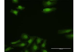 Immunofluorescence of purified MaxPab antibody to FGF13 on HeLa cell. (FGF13 抗体  (AA 1-245))