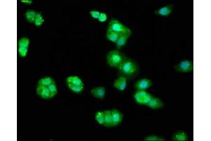 Immunofluorescence staining of HepG2 cells with ABIN7145780 at 1:33, counter-stained with DAPI. (BIN2 抗体  (AA 290-496))