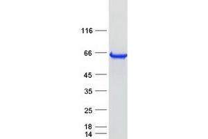 Western Blotting (WB) image for beta-Carotene 15,15'-Monooxygenase 1 (BCMO1) protein (Myc-DYKDDDDK Tag) (ABIN2715210)