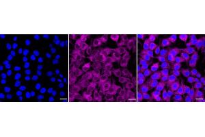 Immunocytochemical staining of HeLa cells with Phospho-mTOR (S(ABIN7800001) antibody (ABIN7799348), 1:1,000). (Recombinant MTOR 抗体  (pSer2448))
