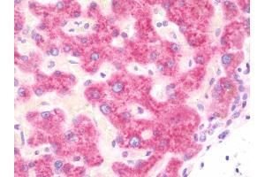Anti-SMPD1 / Acid Sphingomyelinase antibody IHC staining of human liver. (SMPD1 抗体  (AA 391-419))