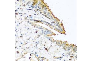Immunohistochemistry of paraffin-embedded mouse lung using RN antibody  at dilution of 1:100 (40x lens).