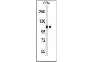 Western blot analysis of RanBP11 / Importin-11 Antibody (C-term) Cat. (Importin 11 抗体  (C-Term))