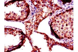Immunohistochemistry of paraffin-embedded human testis tissue using ABIN7156155 at dilution of 1:100 (FKBP6 抗体  (AA 101-327))
