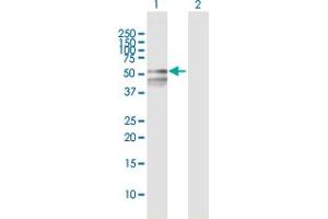 Western Blot analysis of RBMY1F expression in transfected 293T cell line by RBMY1F MaxPab polyclonal antibody. (RBMY1F 抗体  (AA 1-496))