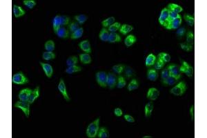 Immunofluorescence staining of PC-3 cells with ABIN7147166 at 1:100, counter-stained with DAPI. (CD59 抗体  (AA 26-102))