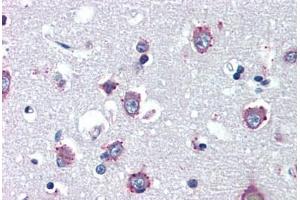 Human Brain, Cortex (formalin-fixed, paraffin-embedded) stained with NPC1 antibody ABIN462125 followed by biotinylated anti-mouse IgG secondary antibody ABIN481714, alkaline phosphatase-streptavidin and chromogen. (NPC1 抗体)