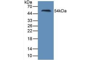 Detection of Recombinant Kim1, Human using Monoclonal Antibody to Kidney Injury Molecule 1 (Kim1) (HAVCR1 抗体  (AA 21-240))