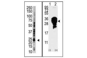 Image no. 1 for anti-Ubiquitin-Conjugating Enzyme E2S (UBE2S) (C-Term) antibody (ABIN357498) (UBE2S 抗体  (C-Term))