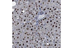 Immunohistochemical staining (Formalin-fixed paraffin-embedded sections) of human liver with PTPN1 polyclonal antibody  shows strong nuclear positivity in hepatocytes. (PTPN1 抗体  (AA 268-406))