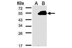WB Image Western Blot analysis of RASSF9 expression in transfected 293T cell line by RASSF9 polyclonal antibody.