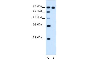 WB Suggested Anti-RRM1 Antibody Titration:  1. (RRM1 抗体  (C-Term))