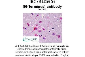 Image no. 1 for anti-Solute Carrier Family 35 (UDP-Glucuronic Acid/UDP-N-Acetylgalactosamine Dual Transporter), Member D1 (SLC35D1) (N-Term) antibody (ABIN1739364)