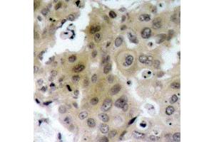 Immunohistochemistry (IHC) image for anti-VEGF Receptor 2 (VEGFR2) (pTyr1175) antibody (ABIN1870314) (VEGFR2/CD309 抗体  (pTyr1175))
