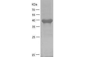 Western Blotting (WB) image for NF-kappa-B inhibitor beta (NFKBIB) (AA 1-356) protein (His tag) (ABIN7124163) (NFKBIB Protein (AA 1-356) (His tag))
