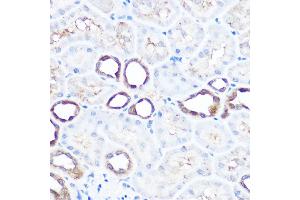Immunohistochemistry of paraffin-embedded rat kidney using HSP70/HSP Rabbit pAb  at dilution of 1:100 (40x lens). (HSP70 1A 抗体  (C-Term))