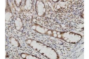 Immunostaining (ISt) image for anti-Cytohesin 2 (CYTH2) (AA 314-398) antibody (ABIN564002)