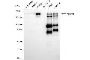 Western blotting analysis using PDGFRB antibody (ABIN7799848).