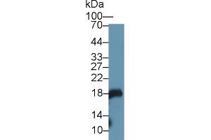 Detection of GKN1 in Mouse Stomach lysate using Polyclonal Antibody to Gastrokine 1 (GKN1) (Gastrokine 1 抗体  (AA 27-151))