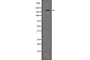 Western blot analysis of NRK expression in A549 cell line lysate ,The lane on the left is treated with the antigen-specific peptide. (NRK 抗体)