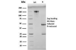 SDS-PAGE Analysis Purified N-Cadherin Mouse Monoclonal Antibody (8C11).