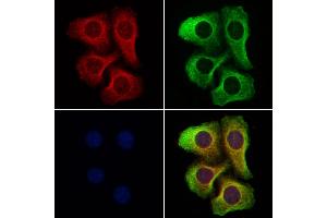 ABIN6262578 and ABIN6277333 staining Hela cells by IF/ICC.