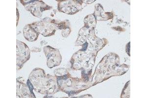 Immunohistochemistry of paraffin-embedded Human placenta using KRT7 Polyclonal Antibody at dilution of 1:100 (40x lens). (Cytokeratin 7 抗体)