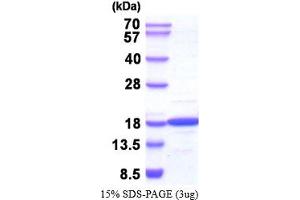 SDS-PAGE (SDS) image for Nucleoside diphosphate kinase B (NME2) (AA 1-152) (Active) protein (ABIN6387709) (NME2 Protein (AA 1-152))