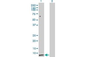 Western Blot analysis of SCT expression in transfected 293T cell line by SCT MaxPab polyclonal antibody. (Secretin 抗体  (AA 1-121))