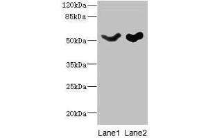 Western blot All lanes: SLC25A25 antibody at 10 μg/mL Lane 1: Mouse liver tissue Lane 2: Mouse brain tissue Secondary Goat polyclonal to rabbit IgG at 1/10000 dilution Predicted band size: 53, 56, 57, 55, 41 kDa Observed band size: 53 kDa (SLC25A25 抗体  (AA 1-189))