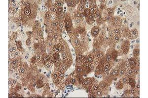 Image no. 12 for anti-Nonhomologous End-Joining Factor 1 (NHEJ1) antibody (ABIN1499729) (NHEJ1 抗体)