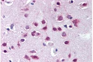 Human Brain, Cortex (formalin-fixed, paraffin-embedded) stained with UBA6 antibody ABIN290255 at 10 ug/ml followed by biotinylated goat anti-rabbit IgG secondary antibody ABIN481713, alkaline phosphatase-streptavidin and chromogen. (UBA6 抗体  (AA 300-350))