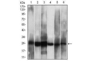 Western blot analysis using CSNK2B mouse mAb against Hela (1), Jurkat (2), C6 (3), MCF-7 (4), SK-N-SH (5), NTERA-2 (6) cell lysate. (CSNK2B 抗体  (AA 1-215))
