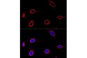 Confocal immunofluorescence analysis of U-2 OS cells using Emerin/Emerin/EMD Polyclonal Antibody  at dilution of 1:100. (Emerin 抗体  (AA 1-220))
