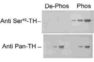 Western blot of recombinant phospho- and dephospho-Th showing selective immunolabeling by the phospho-specific antibody of the ~60k Th phosphorylated at Ser40. (Tyrosine Hydroxylase 抗体)