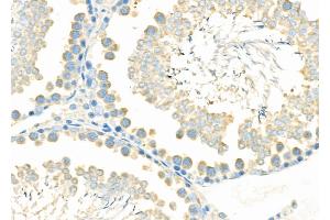 ABIN6265844 and ABIN6276978 at 1/100 staining Rat testis tissue by IHC-P. (UBE2D1 抗体  (C-Term))