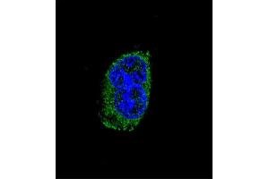 Confocal immunofluorescent analysis of TSHB Antibody (Center) (ABIN652558 and ABIN2842375) with MDA-M cell followed by Alexa Fluor® 488-conjugated goat anti-rabbit lgG (green). (TSHB 抗体  (AA 58-86))
