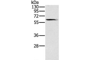 Western Blot analysis of Human fetal brain tissue using SLC45A3 Polyclonal Antibody at dilution of 1:200 (SLC45A3 抗体)