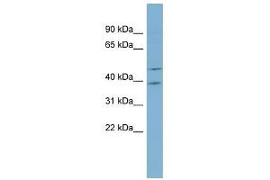 ACTL6B antibody used at 1 ug/ml to detect target protein.